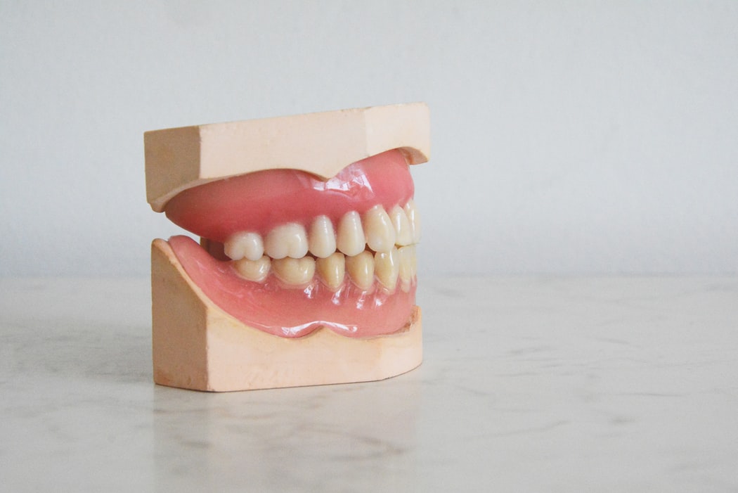 Dental Implants Give You a Reason to Smile - Jack Nagrani Dentistry